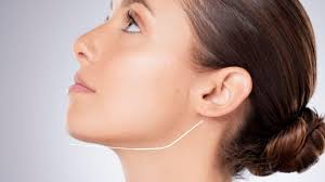 Jawline Reshaping.jpg